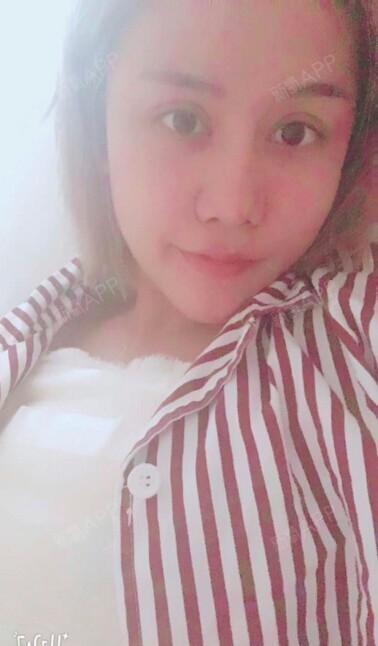 经过再上考虑,我还是选择去把胸隆了,因为本身就很小_圈子-新氧美容