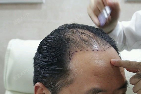 影视歌三栖演员仇金豹夫妇,奥运冠军(蔡良蝉)体能教_圈子-新氧美容