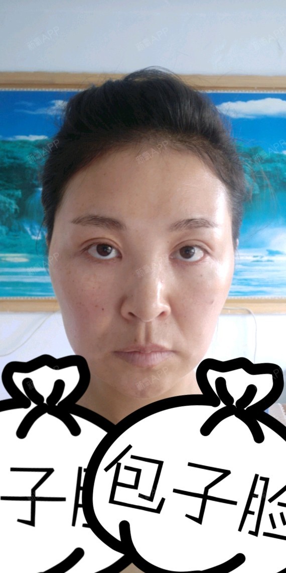 奇葩的眼角都不对称!失败 !