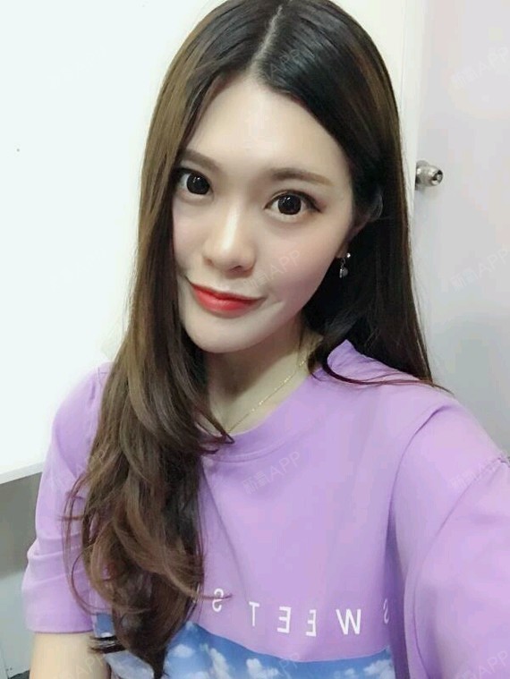 整形鼻翼外漏线怎么拆_整形鼻翼整形_鼻翼整形