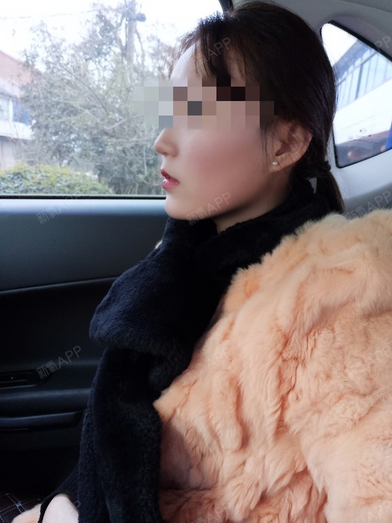 今天是术后第二天,不爽就是昨天大姨妈来了,肚子