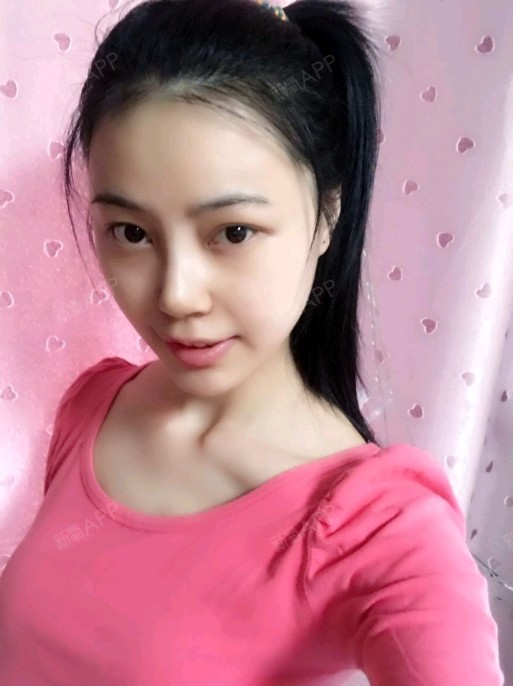 乐大喜膨体隆鼻第7天美丽日记