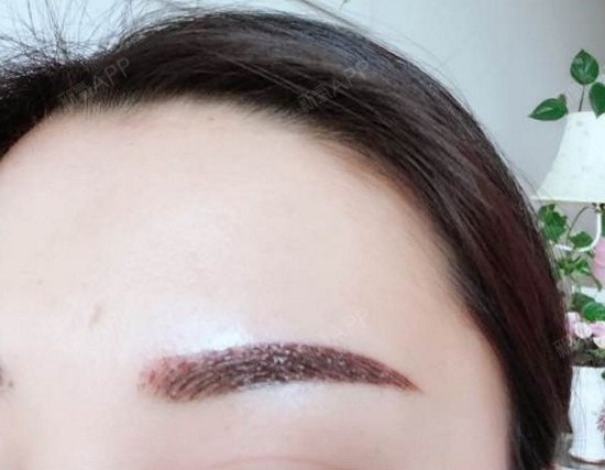 今天是纹眉后的第4天,有点结痂发硬了,眉毛还不能碰_圈子-新氧美容