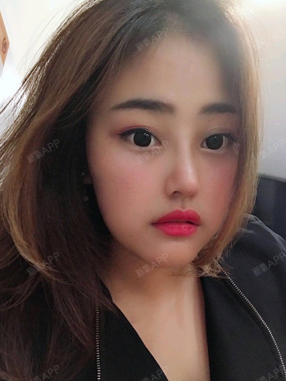 [图片]我认为我恢复很棒了现在再也不用化鼻影化很重了,随便化个简单