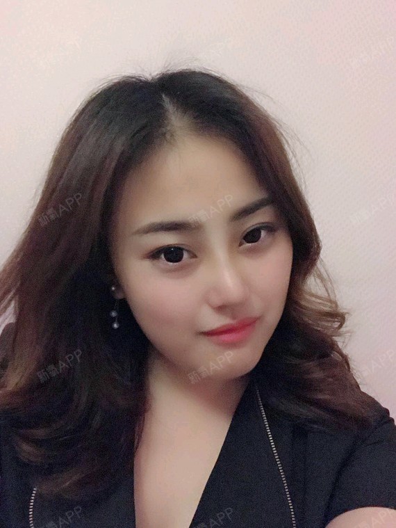 [图片]我认为我恢复很棒了现在再也不用化鼻影化很重了,随便化个简单