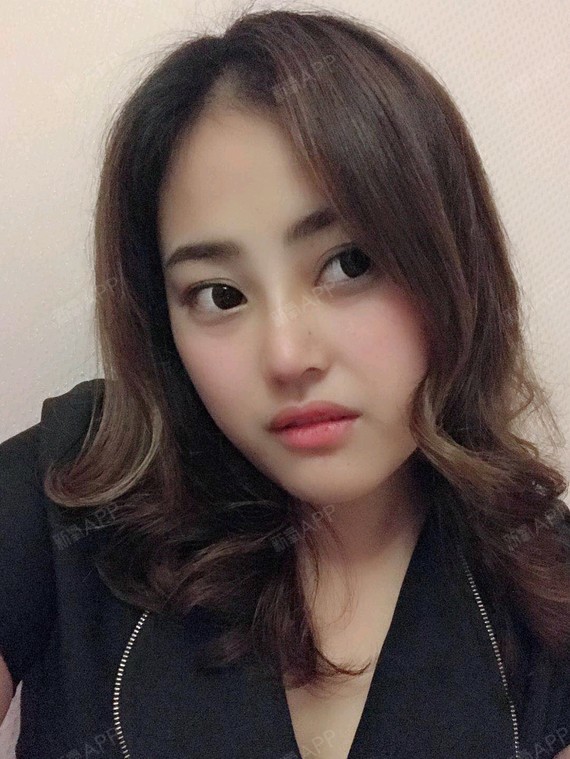 [图片]我认为我恢复很棒了现在再也不用化鼻影化很重了,随便化个简单