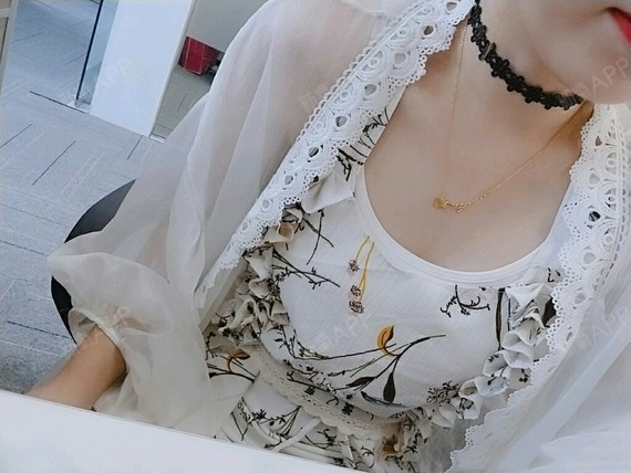 因为医院可以每天就诊到晚上九点,所以今天跟医生预约_圈子-新氧美容