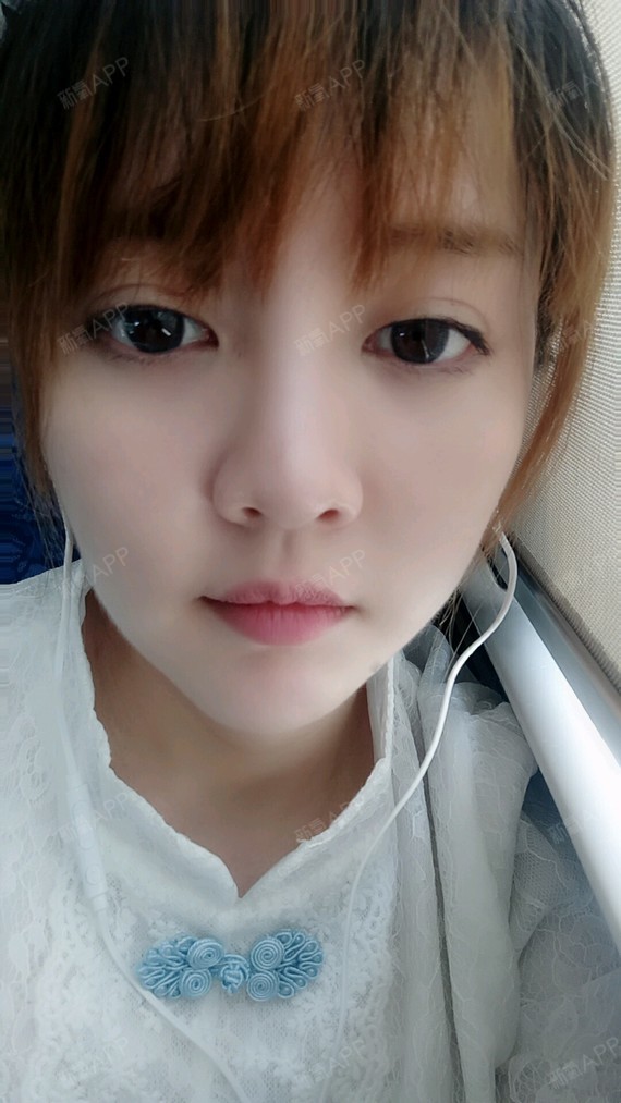 广州吸脂瘦大腿好不好_效果图_坚决不做女网红吸脂瘦大腿术后第13天