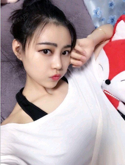 重庆膨体隆鼻好不好_效果图_乐大喜膨体隆鼻术后第13天_新氧美容整形