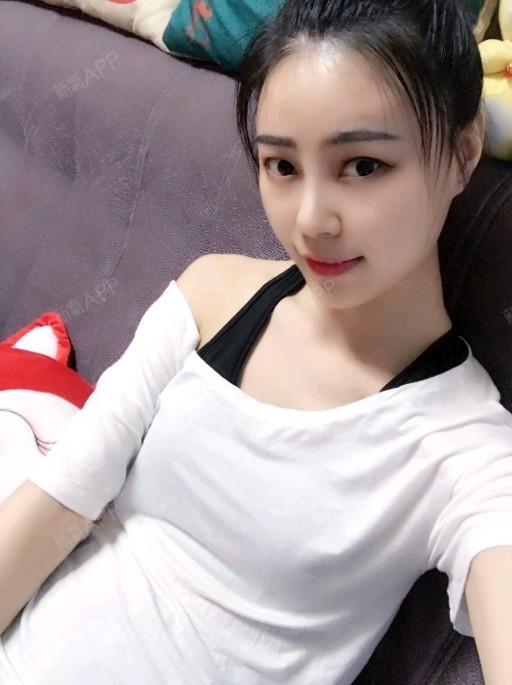 重庆膨体隆鼻好不好_效果图_乐大喜膨体隆鼻术后第13天_新氧美容整形