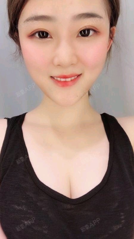 新氧- 三月份的可爱 | 胸部 | 隆胸 | 假体隆胸 | 术后当自强 | 杭州