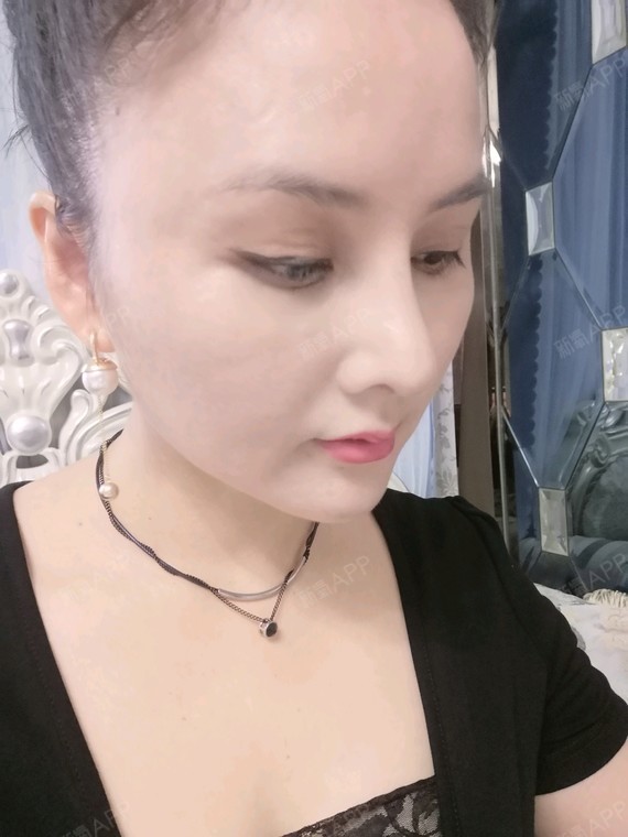 氧气x3szc玻尿酸全脸填充第7天美丽日记