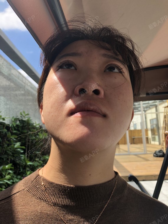 日常晒照,今天感觉整体脸部轮廓变得明显多了,整个脸_圈子-新氧美容