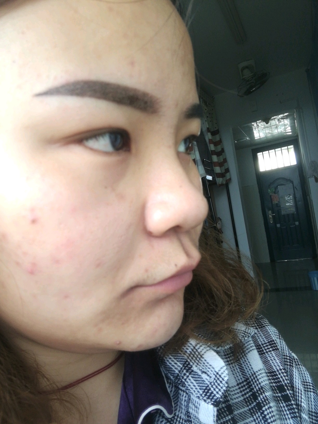 我这个鼻子可以只单独做个鼻翼缩小鼻头_新氧-专业医美服务平台