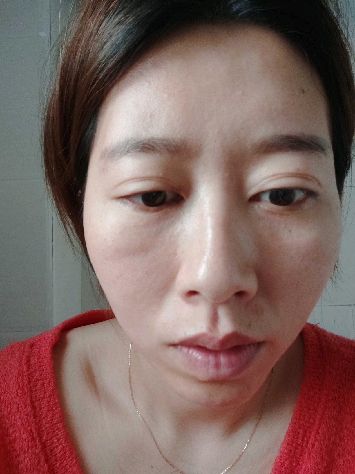 你好双眼皮过宽眼球凸无神是做眼部多项还是眼修复06