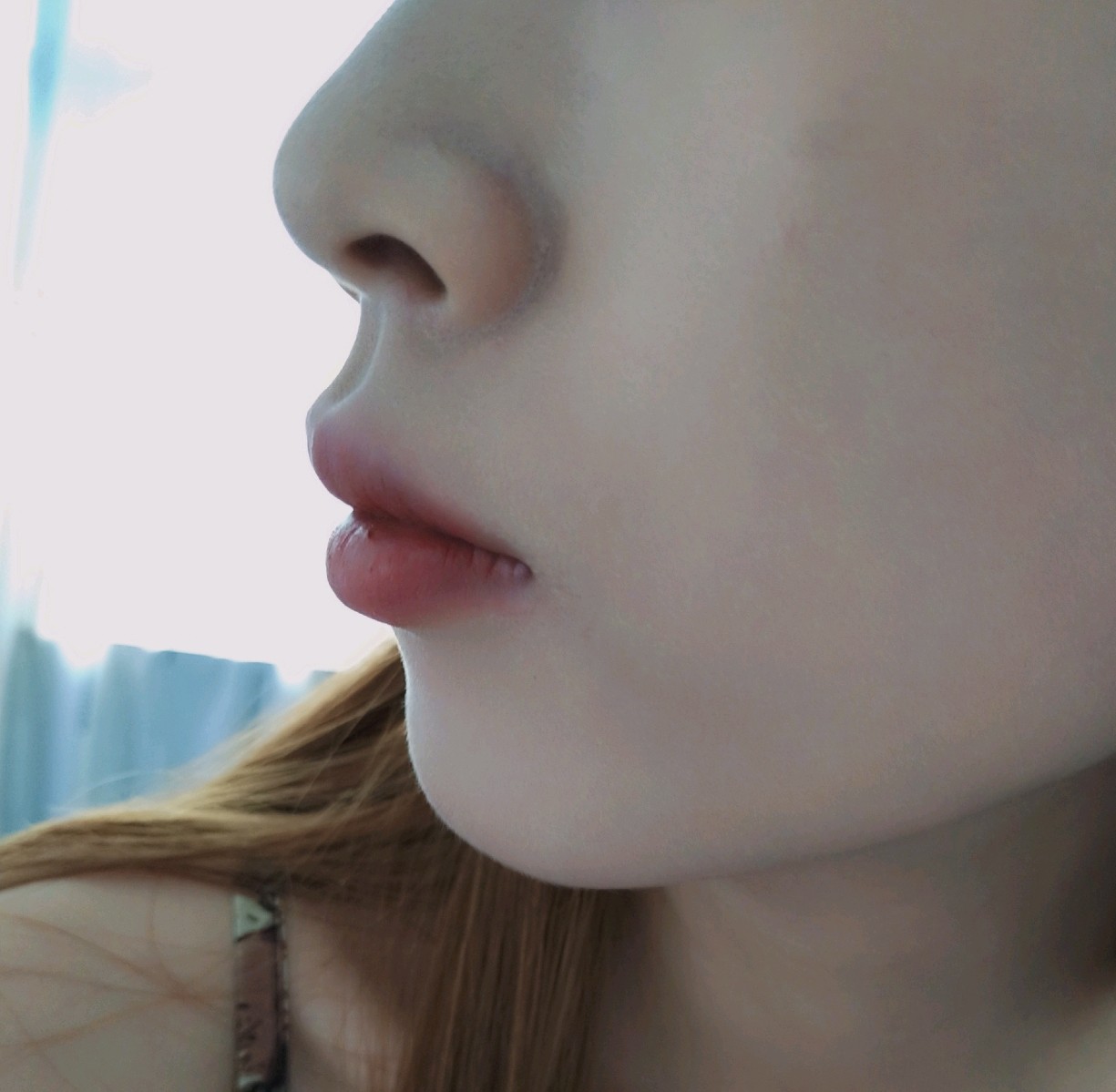 人中缩短术会显得上颚更突出吗