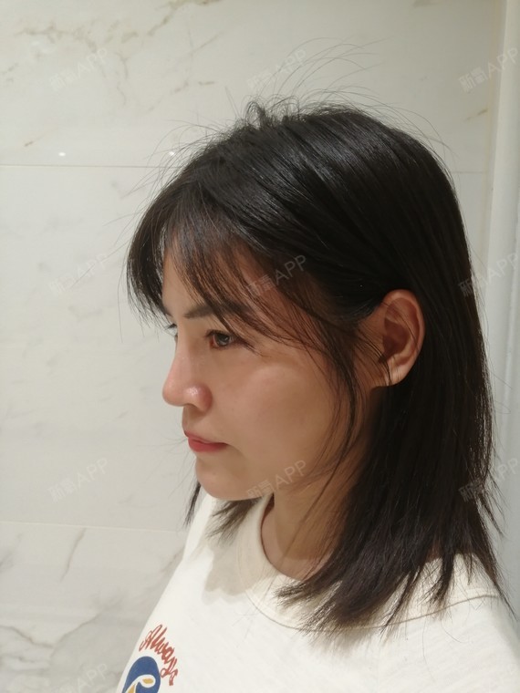 我开始正常上班啦,本来还以为要在家恢复几天才可以出门呢,然后做完就