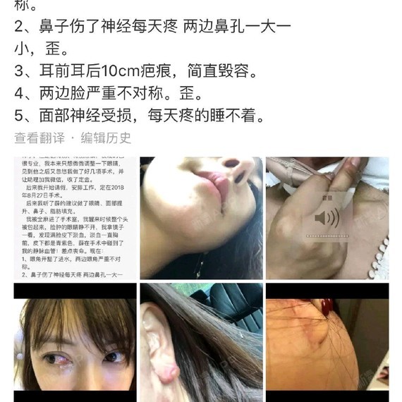 超体鼻假体的蜂巢结构能带来哪些惊喜来一起看看薛志强博士的回答吧