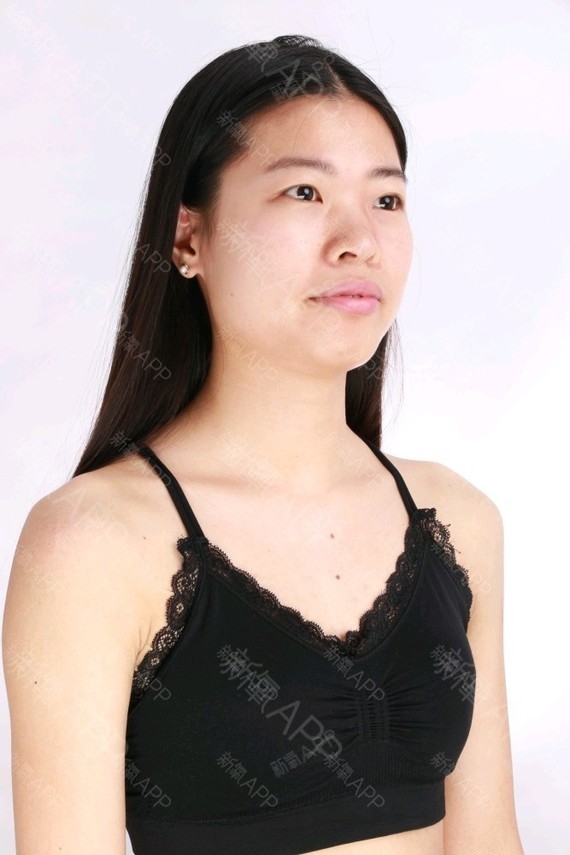 2019年11月20日我做了胸部手术,那天天气不好_圈子-新氧美容整形