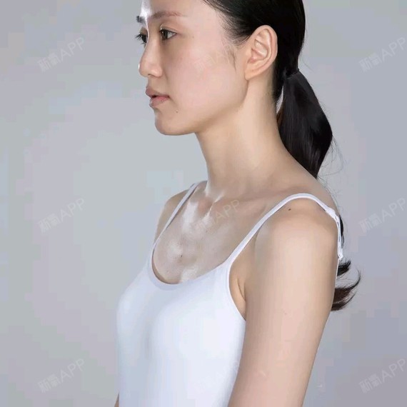 胸部发育较小,胸部平坦,建议给予假体隆胸手术