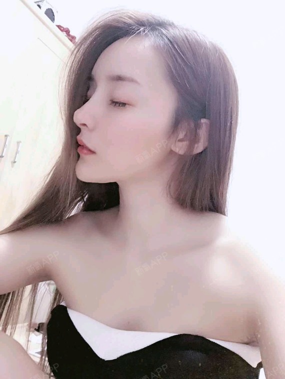 肋软骨隆鼻
