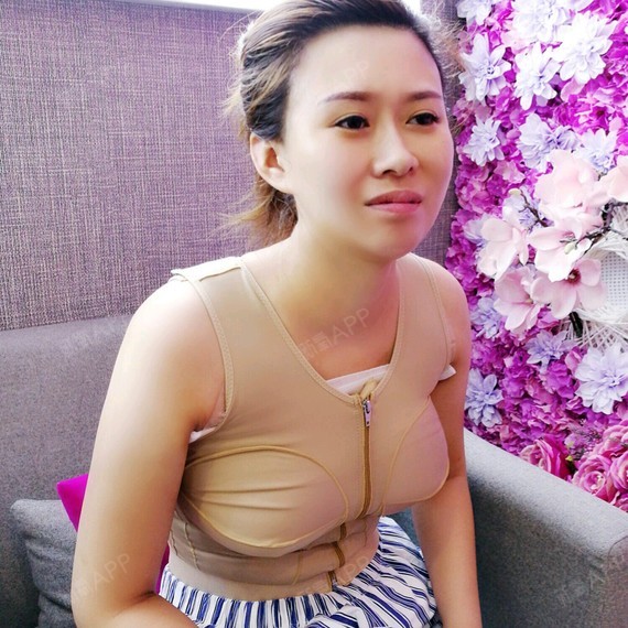 沈阳童颜果冻隆胸