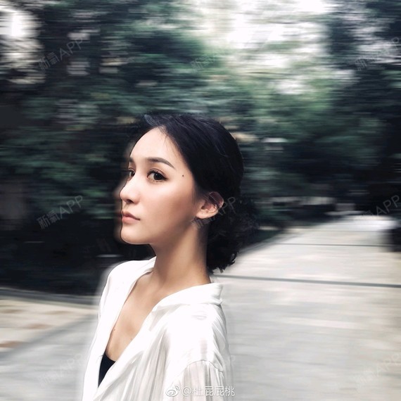 鼻部多项好不好_效果图_莫西子麦鼻部多项术后第63天_新氧美容整形