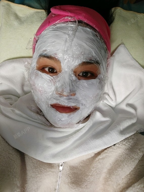 伊肤泉微针好不好_效果图_痒痒猫咪伊肤泉微针术后第78天_新氧美容