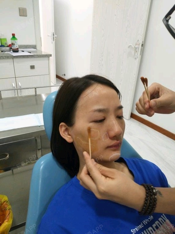 溶解酶