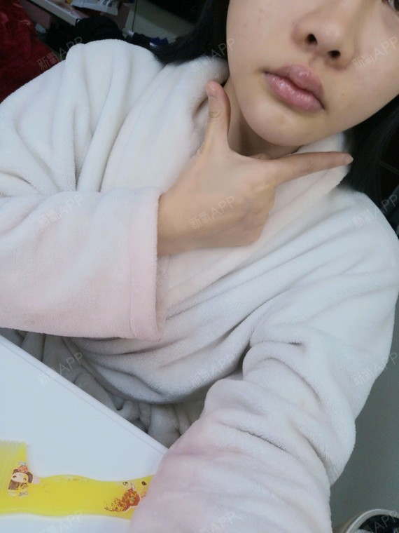 溶解酶