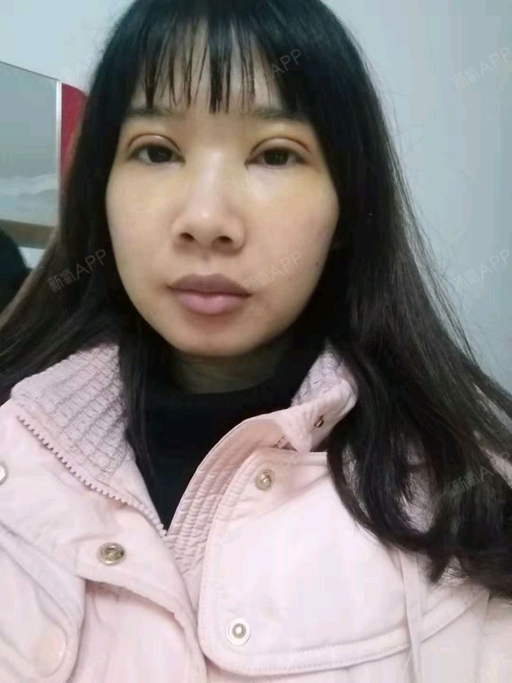 郑州美丽之星整形美容图片