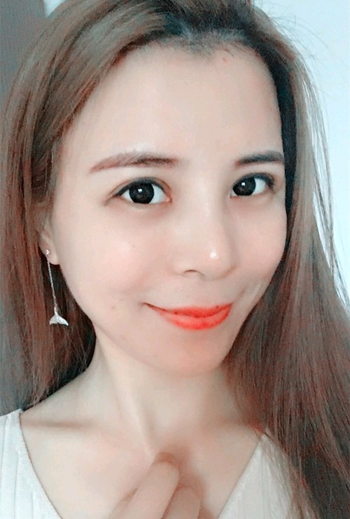 内切去眼袋怎么样_恢复过程_效果如何_懿火整