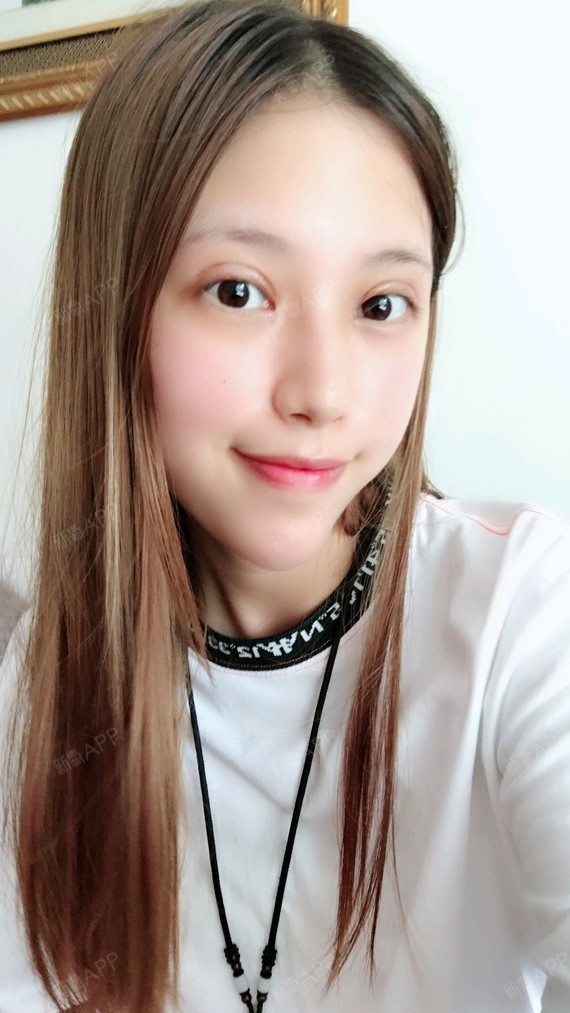 广西壮族自治区南宁眼部多项好不好_效果图_小竹筒2眼部多项术后第15