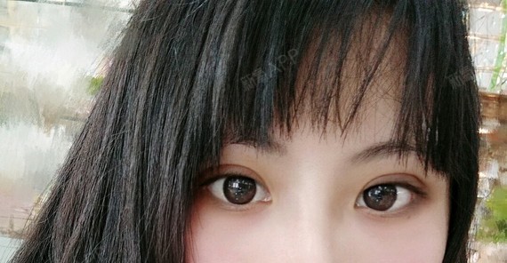 术前初眼一个小双一个内双,有内眦内眦赘皮眼睛上面的_圈子-新氧美容