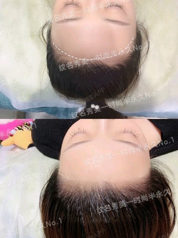 半永久纹发际线