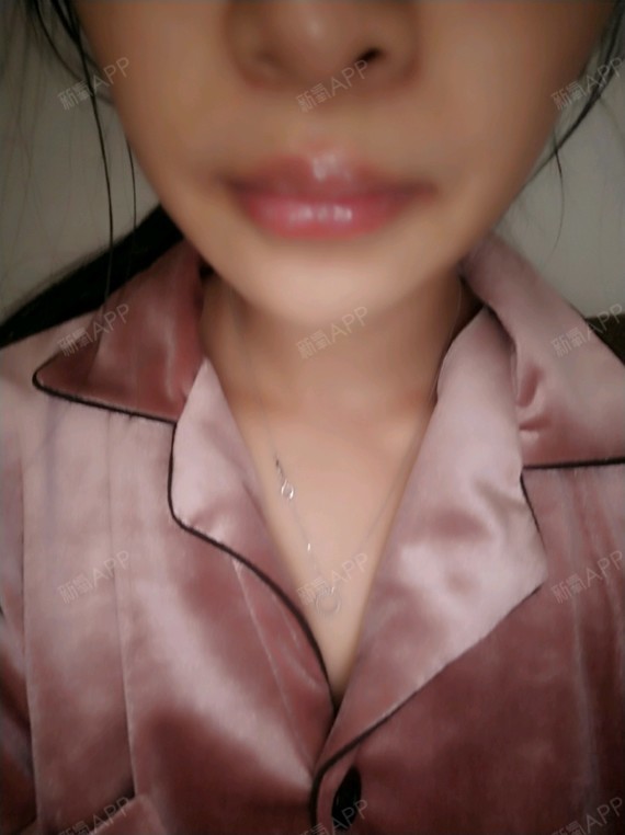 我想说这是嘟嘟唇吗.技术也太差了.