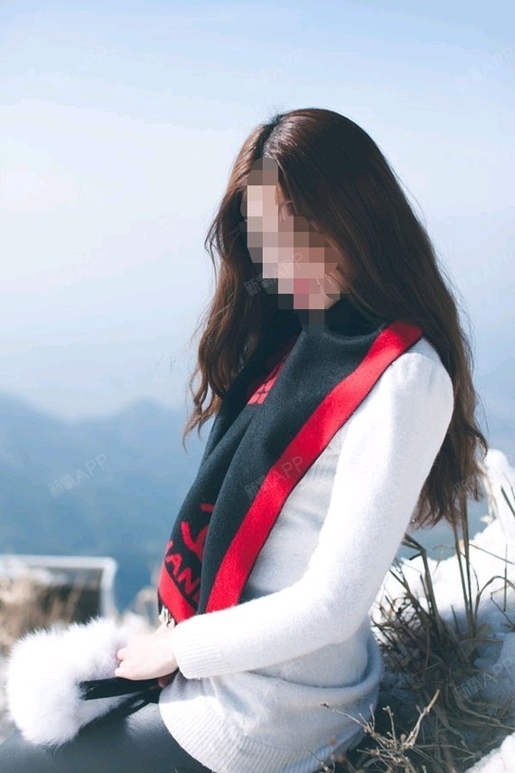 今天在新氧上预约了两天后的手术,内心并不是很平静的_圈子-新氧美容