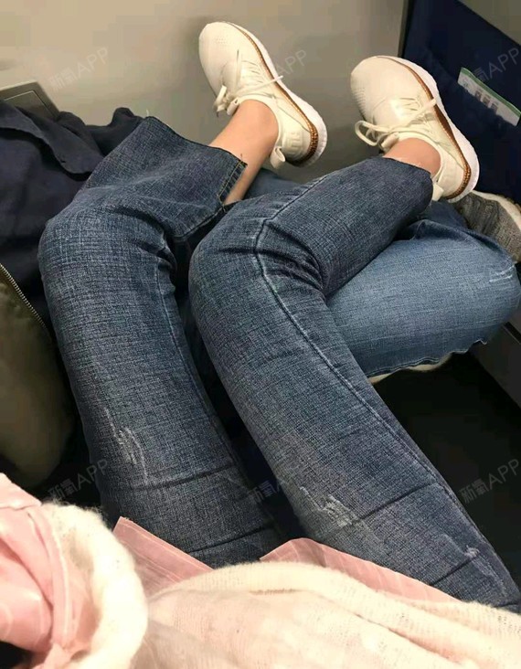 成都手术紧缩阴道好不好_效果图_刘嘉艺手术紧缩阴道术后第174天_新氧