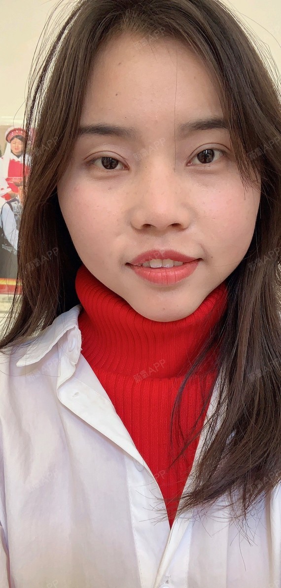 夏娃娃008上颚前突/天包地第76天美丽日记