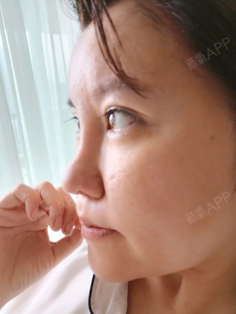 鼻头下垂的女人图片