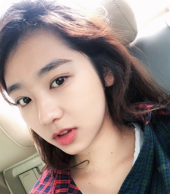 化妆后双目有神眼睛更大,更漂亮了,整体来说这次双眼_圈子-新氧美容