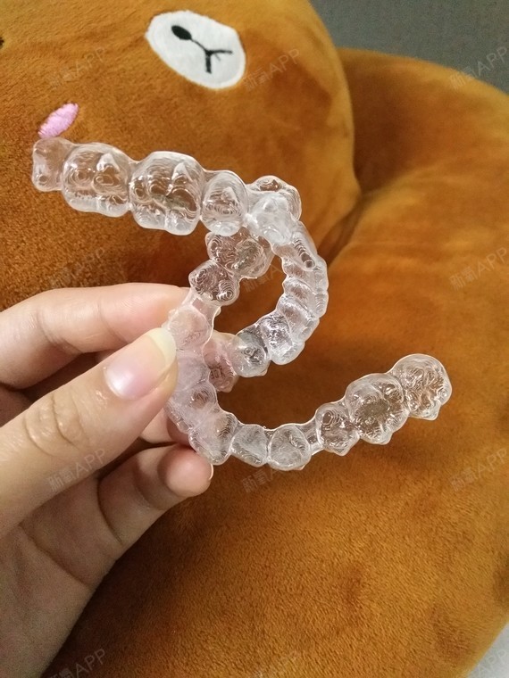 隐形牙套初体验
