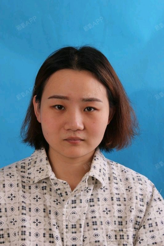 重睑去皮去脂开内眼角_圈子-新氧美容整形