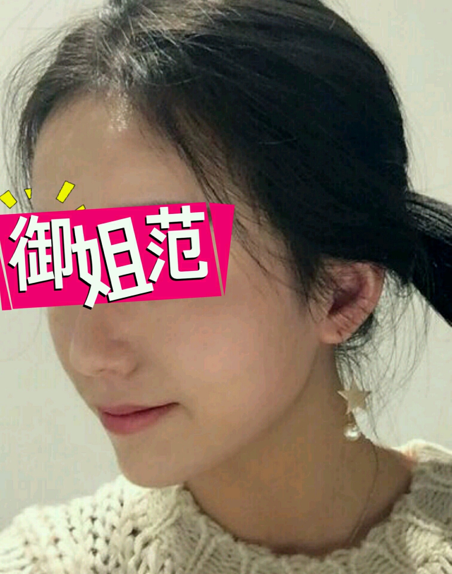 dr reborn唯专 皮秒激光怎么样_恢复过程_效果如何_氧气zjjhp整形日记