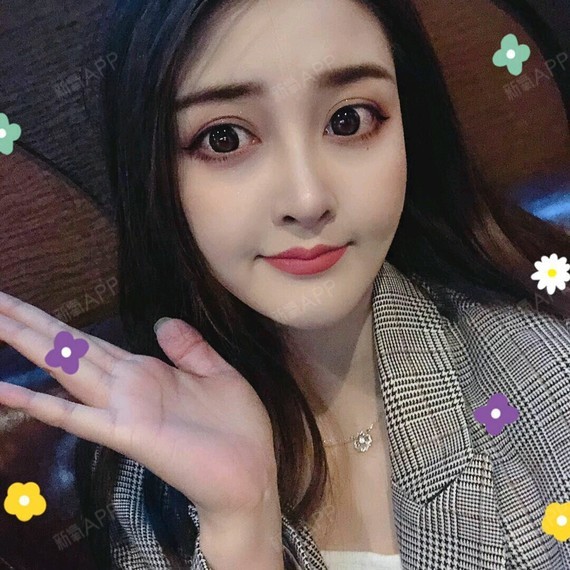 注射瘦脸好不好_效果图_岳岳bar注射瘦脸术后第241天_新氧美容整形