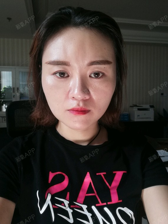 第六天了,脸还是歪的!