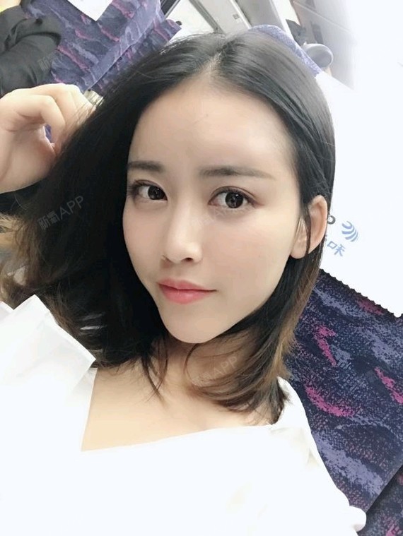 激光祛斑好不好_效果图_雷厉风行啊激光祛斑