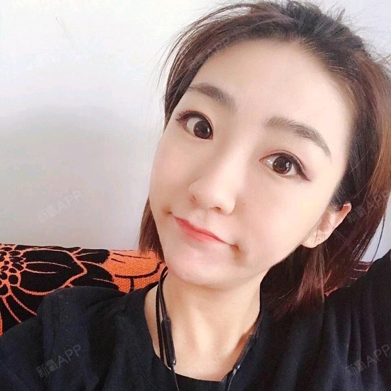 激光祛斑好不好_效果图_氧气2tl10激光祛斑术