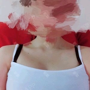 五四青年节我做了丰胸,我以后就是成熟女性了.