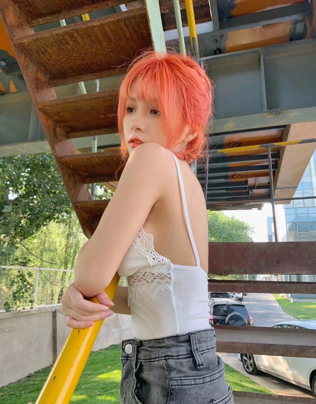 自体脂肪隆胸第115天